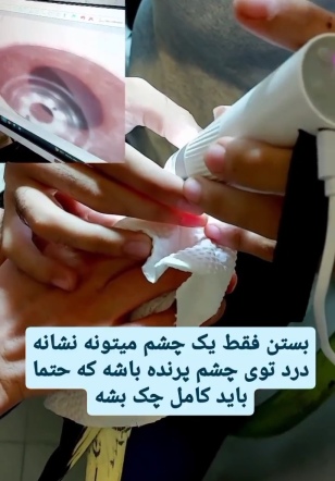 معاینه دقیق پر و چشم با دستگاه 